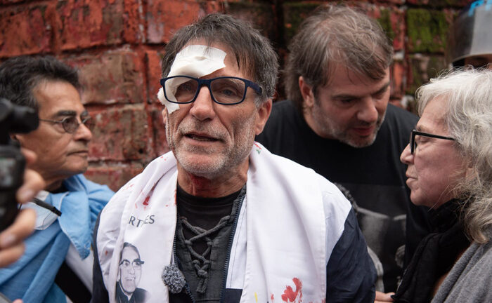 «Paco» Olveira, víctima de la represión en la marcha de jubilados